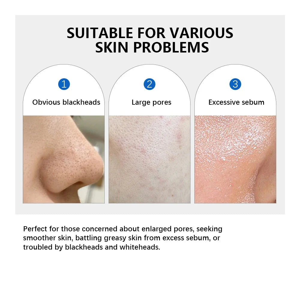 Zero Pore Toning Pads